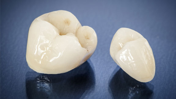 Cosmetic Dentistry St. Johns, MI