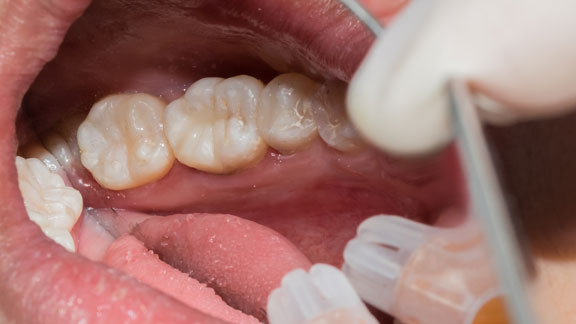 Cosmetic Dentistry St. Johns, MI