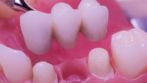 Cosmetic Dentistry St. Johns, MI