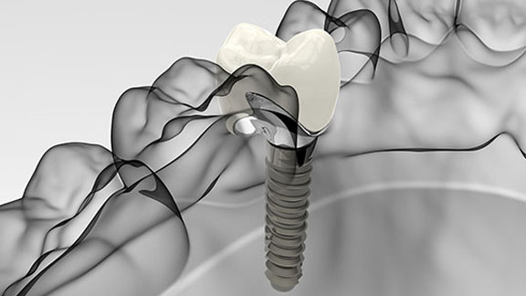 Cosmetic Dentistry St. Johns, MI
