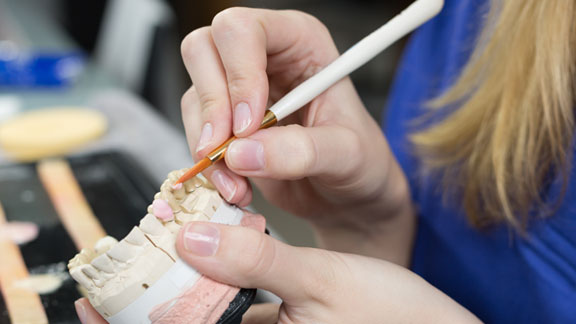 Dental Veneers St. Johns, MI